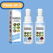 Load image into Gallery viewer, Herbal Psoriasis Relief Spray (Pack Of 2)
