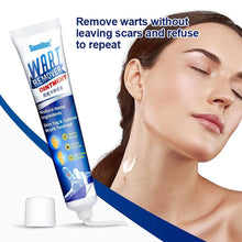 Load image into Gallery viewer, Warts Remover Cream Extract Skin
